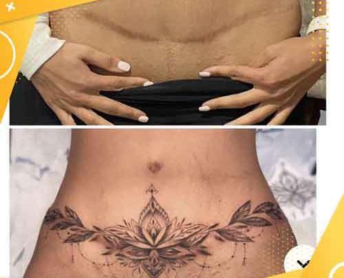 عکس تاتو روی جای زخم دست
