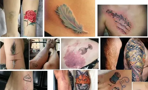 عکس تاتو روی جای زخم دست