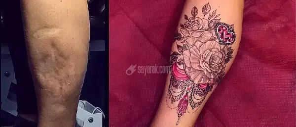 عکس تاتو روی جای زخم دست