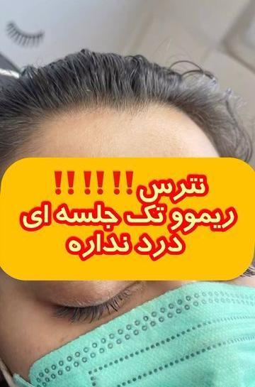 عکس تاتو قلب شکسته زیر چشم