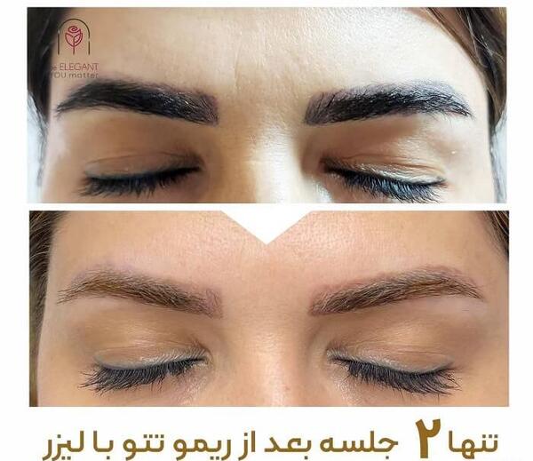 عکس پاك كردن تاتو خط چشم نی نی سایت