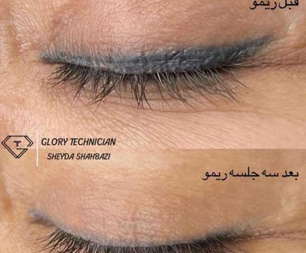 عکس پاك كردن تاتو خط چشم نی نی سایت