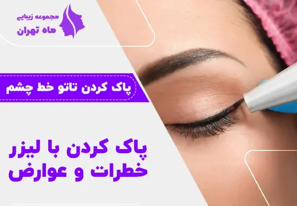 عکس پاك كردن تاتو خط چشم نی نی سایت