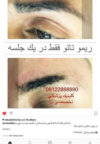 عکس پاك كردن تاتو خط چشم نی نی سایت