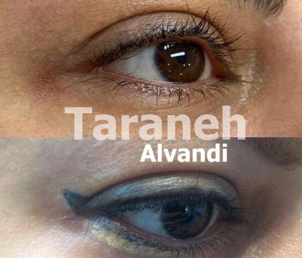 عکس عوارض تاتو خط چشم نی نی سایت