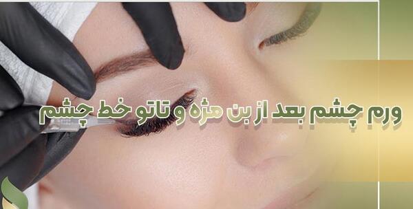 عکس چه پمادی برای تاتو خط چشم خوبه