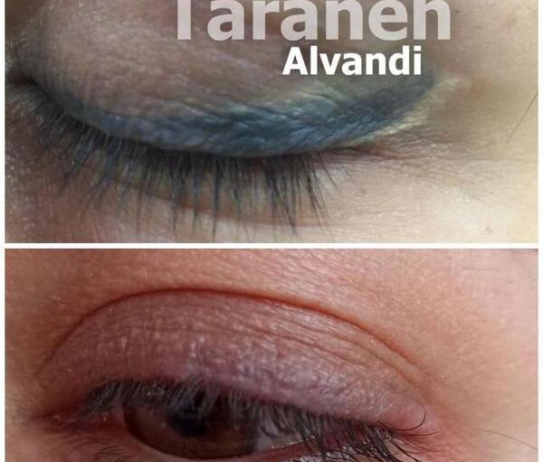 عکس چه پمادی برای تاتو خط چشم خوبه