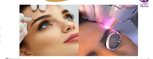 عکس لیزر تاتو ابرو چند جلسه است