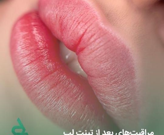 عکس تاتو لب صورتی