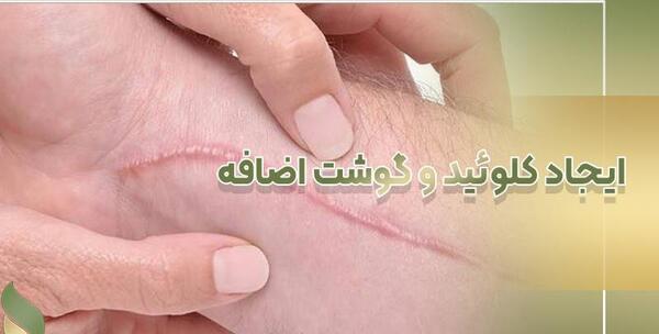 عکس تاتو ضرر دارد