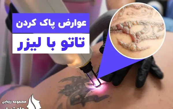 عکس ایا تتو ضرر داره