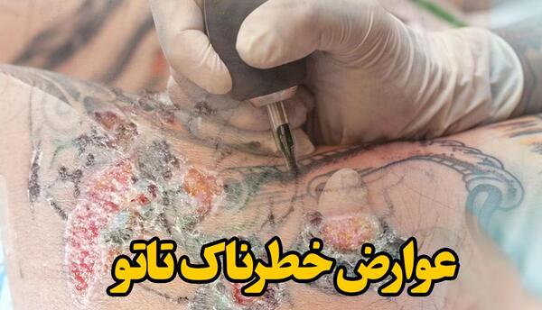 عکس ایا تاتو ضرر دارد؟