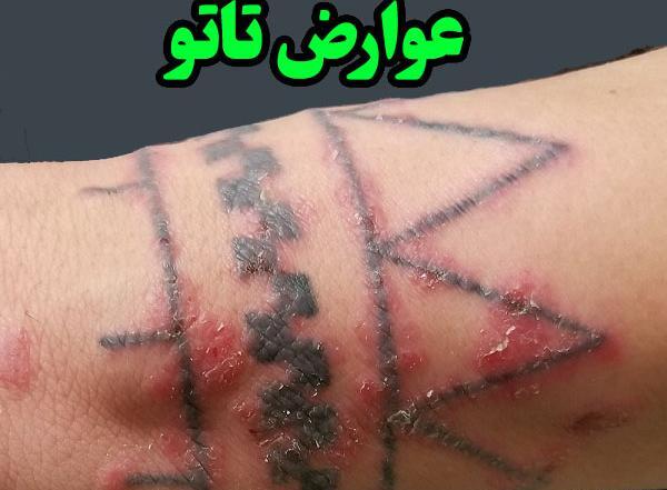 عکس ضرر های تاتو