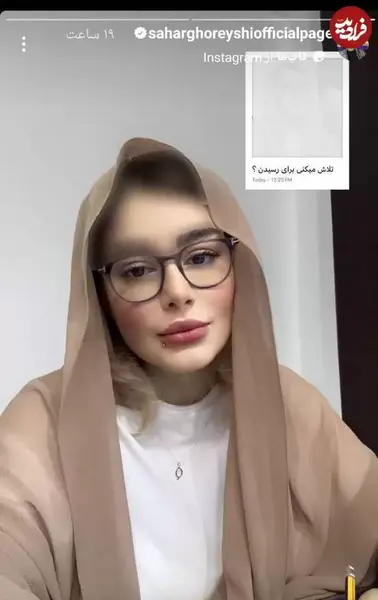 عکس صورت تتو شده ی سحر قریشی