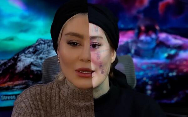 عکس صورت تتو شده سحر قریشی