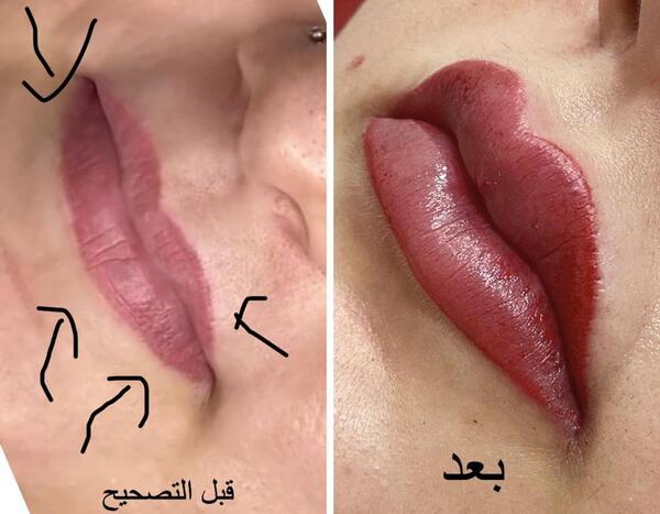 عکس تاتو شفايف قبل وبعد