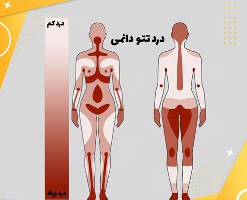 عکس تاتو زانو دخترانه