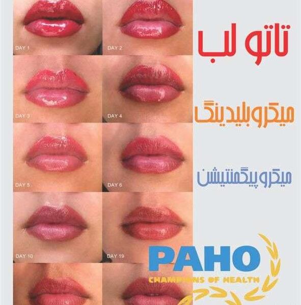 عکس تاتو زدن لب