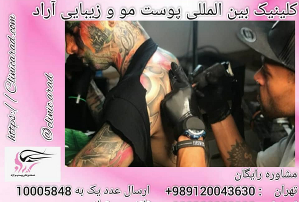 عکس تاتو زدن تتلو
