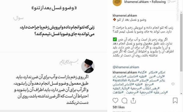 عکس تاتو در دین اسلام حرام است
