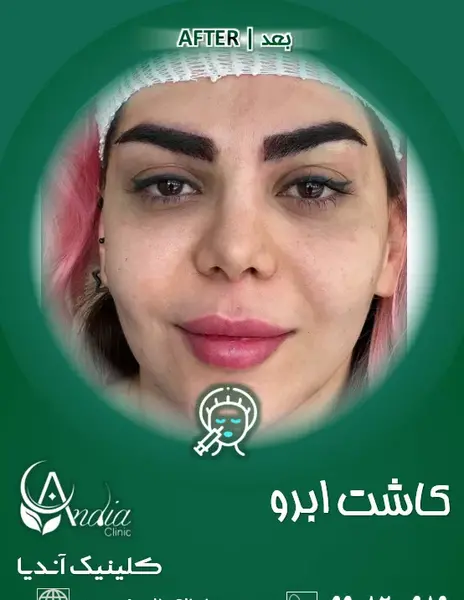 عکس تاتو ابرو در تهران