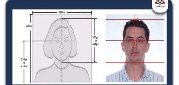شرایط عکس لاتاری چیست