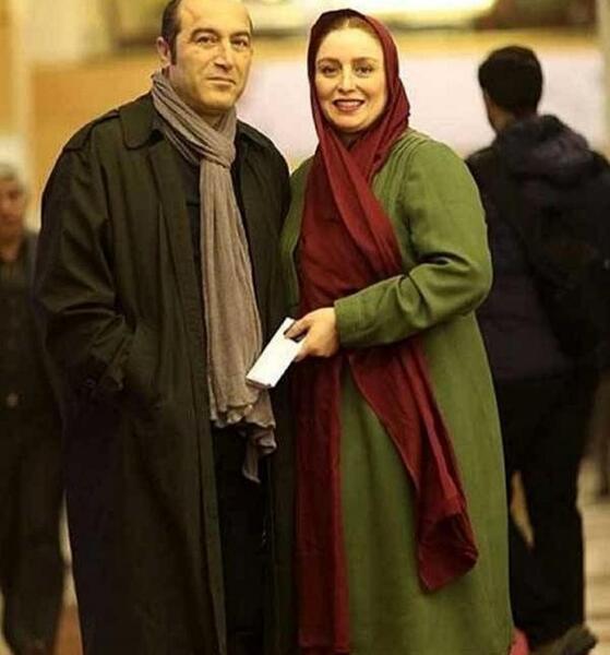 عکس ژاله صامتی قبل عمل