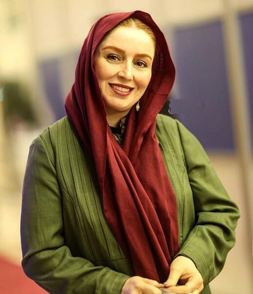 عکس ژاله صامتی قبل عمل