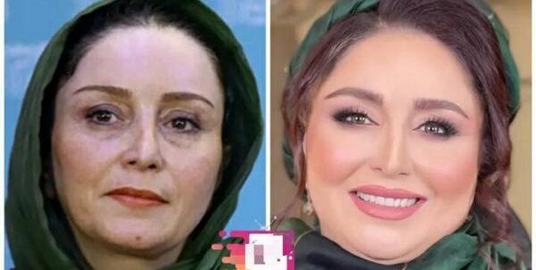 عکس ژاله صامتی قبل عمل