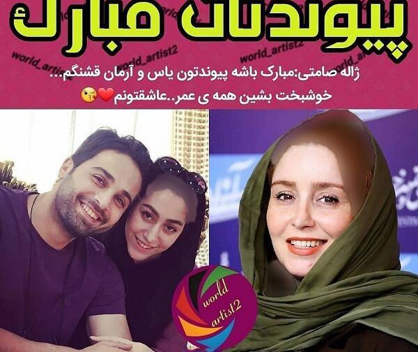 عکس ژاله صامتی قبل عمل