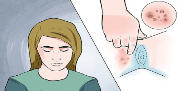 عکس زگیل تناسلی در زنان داخل واژن