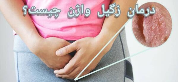 عکس زگیل تناسلی در زنان داخل واژن