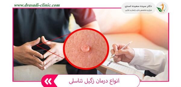 عکس زگیل تناسلی در زنان درمان