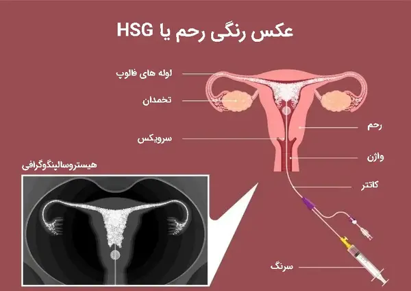 عکس رنگی رحم چگونه انجام میشود