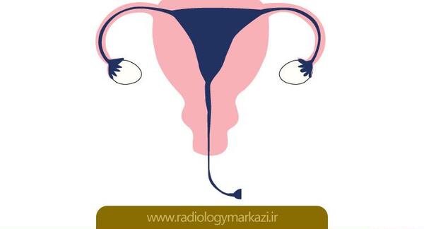 عکس رنگی رحم برای چیست