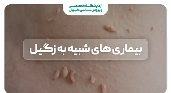 عکس زگیل تناسلی در مردان خفیف