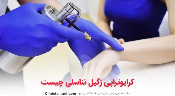 عکس زگیل تناسلی بعد از کرایو