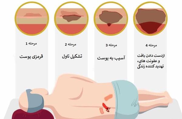 عکس ببر صورت زخمی