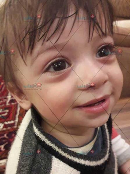 عکس بچه صورت زخمی