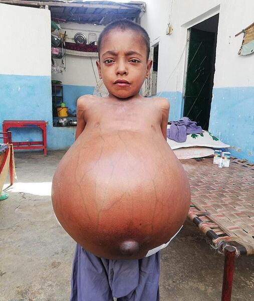 عکس بچه عجیب غریب