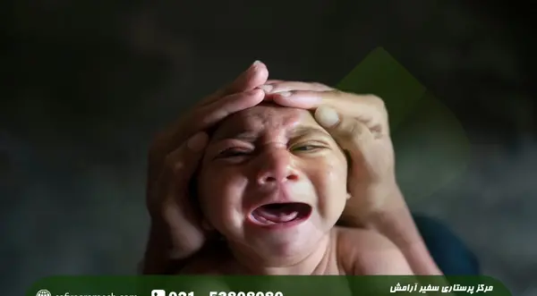 عکس بچه های میکروسفالی