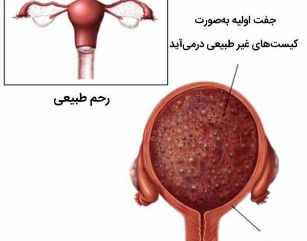 عکس از بچه خوره