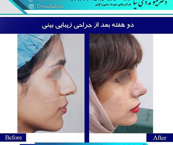 عکس حنجره در اهواز
