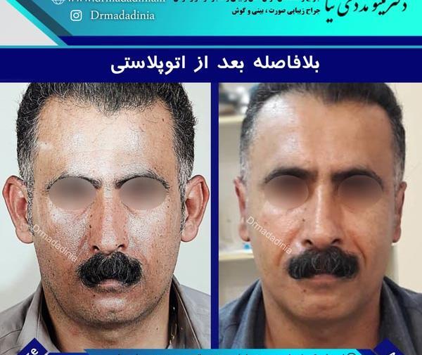 عکس حنجره در اهواز