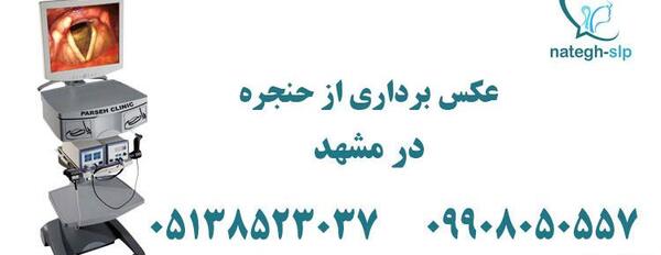 عکس حنجره در اهواز