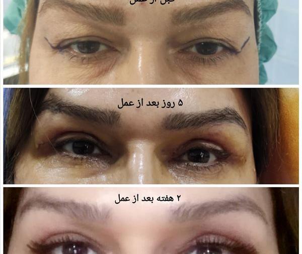 عکس چشم پزشکی اهواز