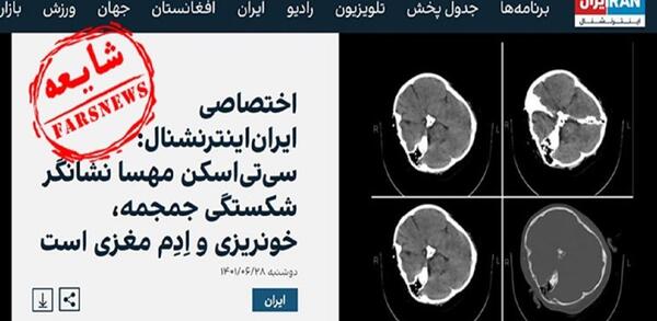 عکس خون گوش مهسا امینی