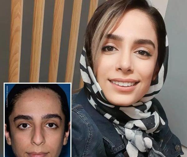 عکس های روز اول عمل بینی