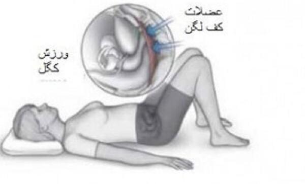 عکس ورزش کگل برای زنان