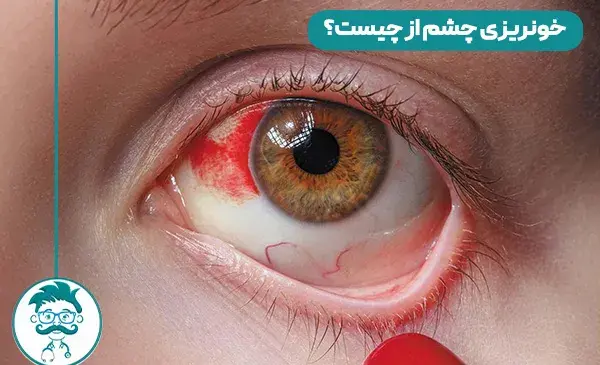عکس یک قطره خون